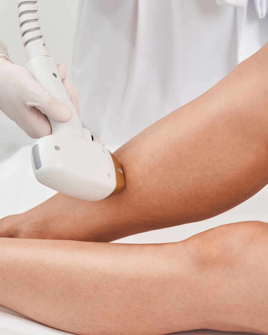 Tratamento de depilação a laser no Indi Beauty Estoril para redução permanente de pelos, tecnologia estética segura e resultados duradouros.